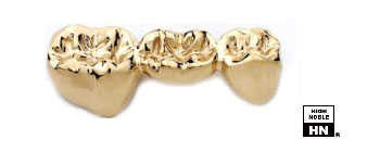Dental Alloy Gold Aurident