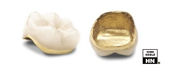 Dental Ceramic Gold Casting - Auribond 97