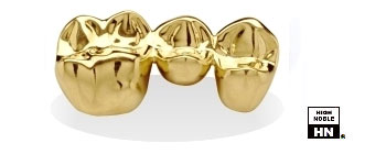 Dental Gold casting Aurident BH