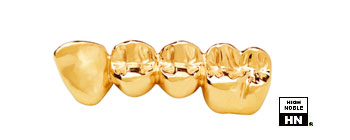 Dental Casting Gold -Aurident - GH