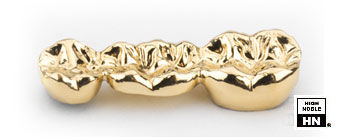 Dental Casting Gold -Aurident IH