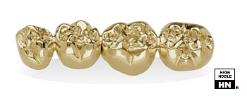 Dental Casting Gold - Aurident QH