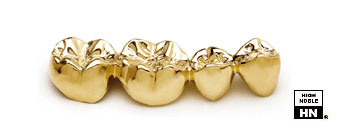 Dental Casting Gold - Aurident - WX