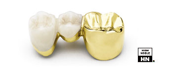Dental Ceramic Gold Casting - Auribond 90