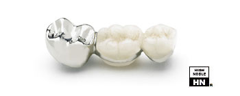Dental Ceramic Gold Casting - Auritex 40