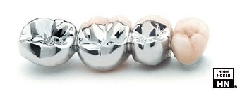 Dental Ceramic Gold Casting - Auritex 66