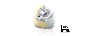 Dental Ceramic Gold Casting - Auritex LP