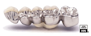 Dental Ceramic Gold Casting - Auritex WP