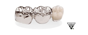 Dental Ceramic Gold Casting - Auritex ZP
