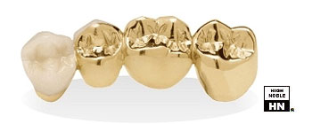 Dental Ceramic Gold Casting - Elite II