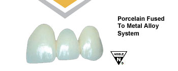 Dental Ceramic Gold Casting - Aurident Vanguard