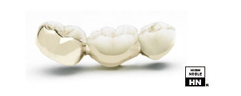 Dental Ceramic Gold Casting - Windzor